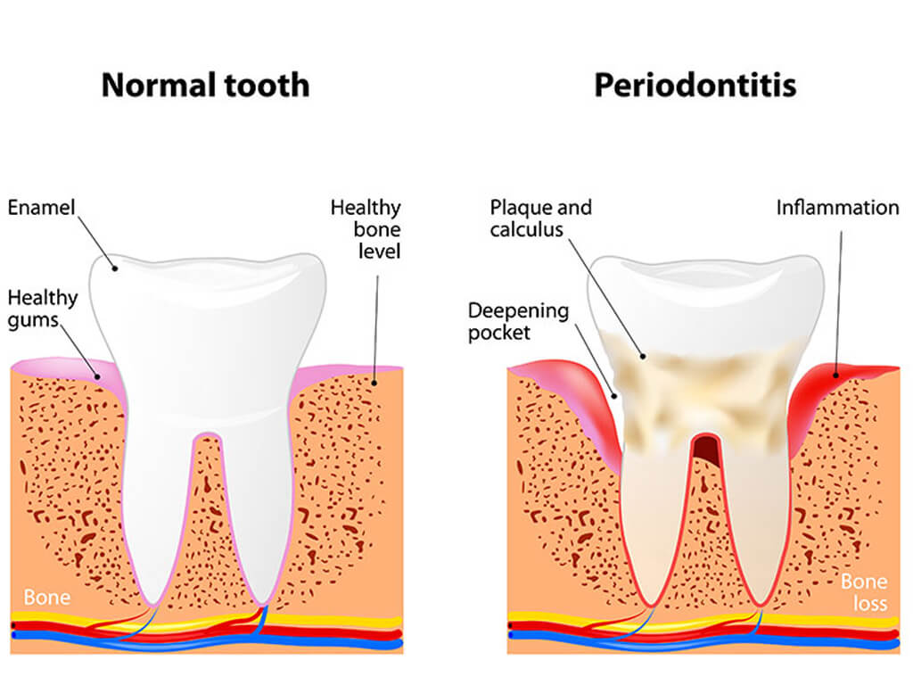 Dentist In Alvin TX Periodonics