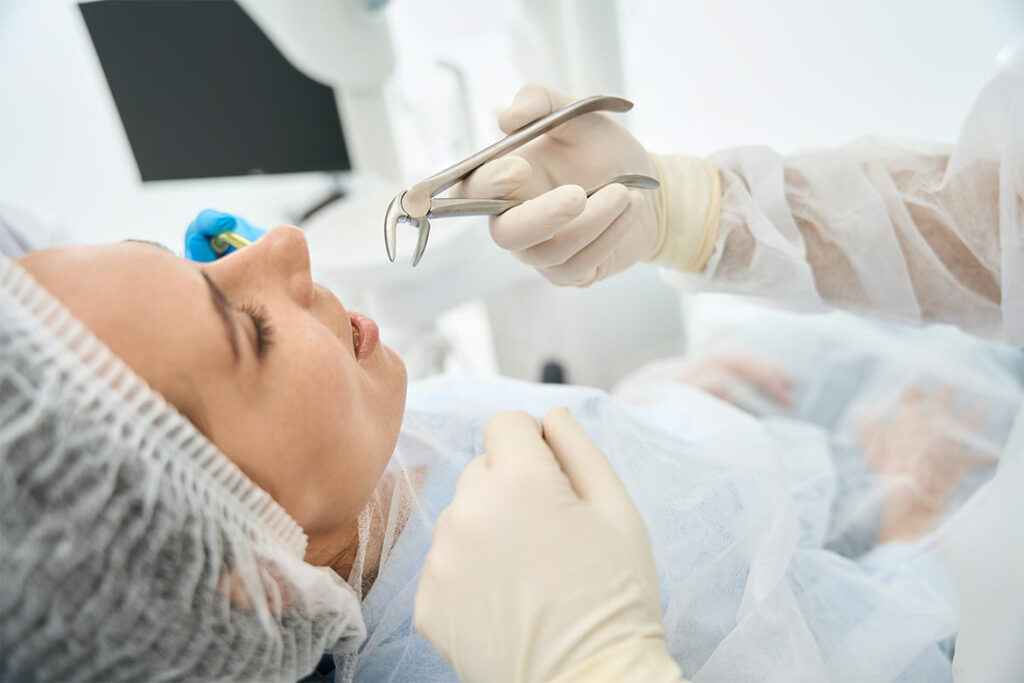 Tooth Extractions