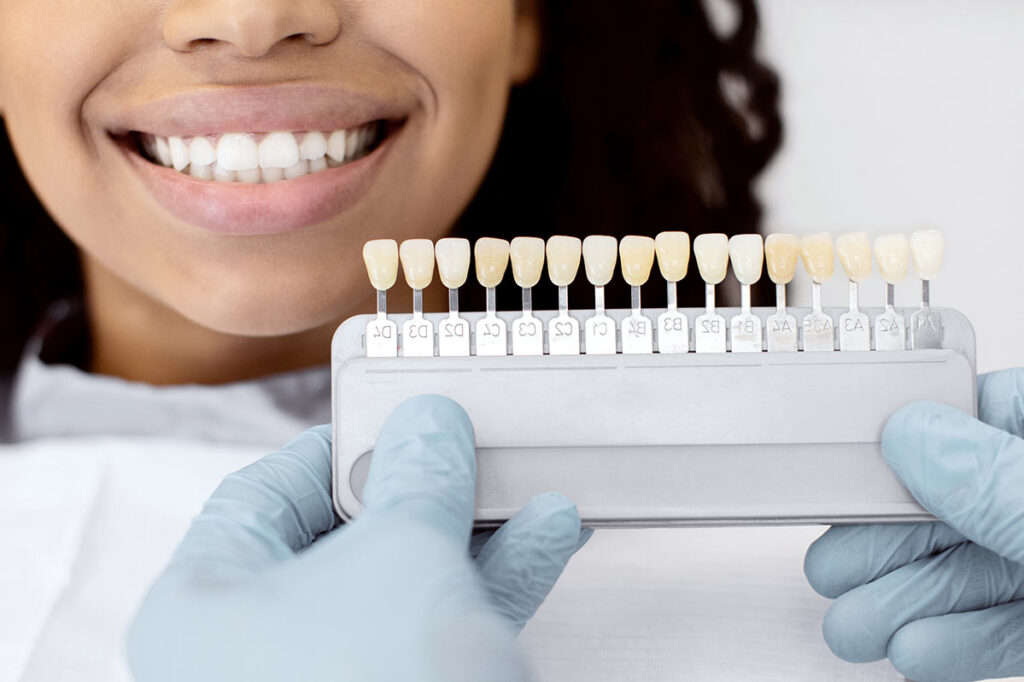 teeth whitening