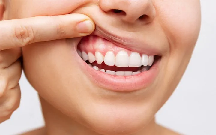 gum disease
